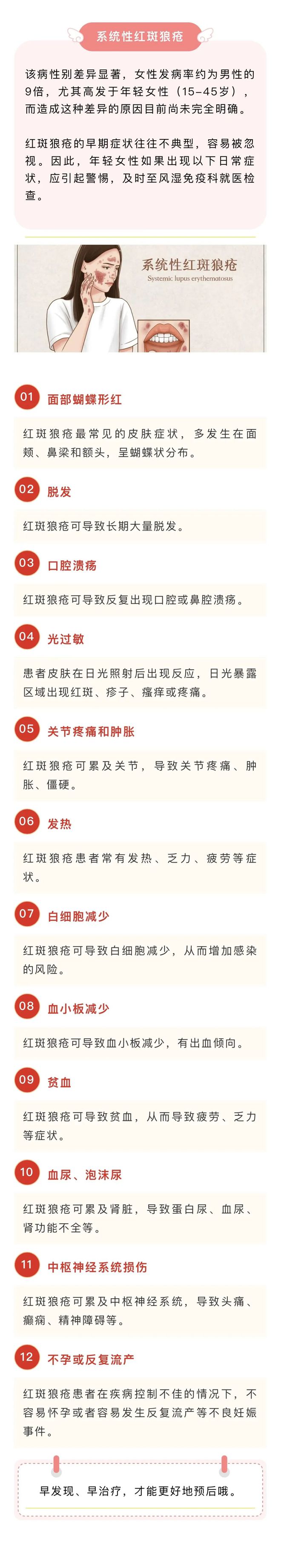 热点轻度红斑狼疮能活多久以及红斑狼疮能活多久的分享