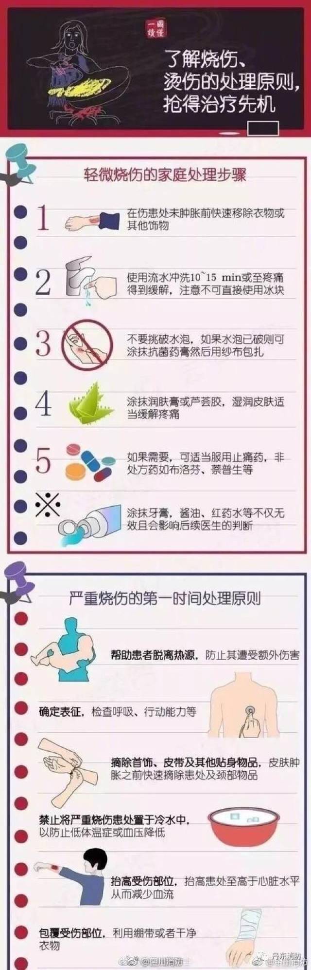 热点烫伤怎么治疗以及烫伤如何处理的分享