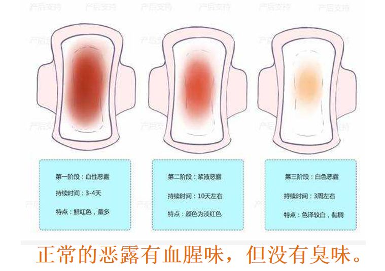 热点产后恶露多久排完正常以及产后恶露多久的分享