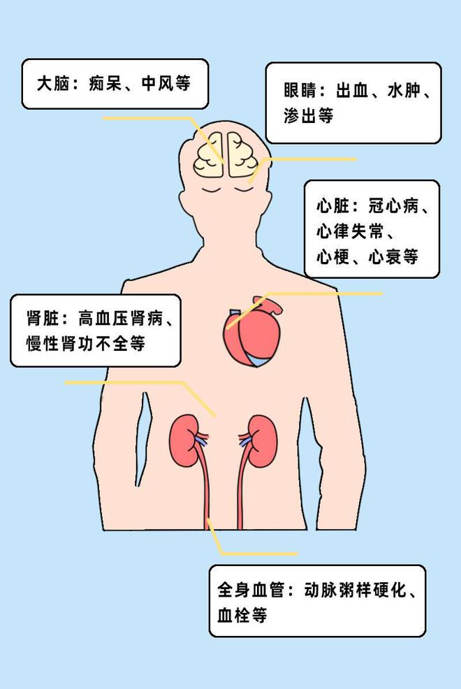 引发高血压的危险因素有哪些，关于高血压的危险因素有哪些详细情况