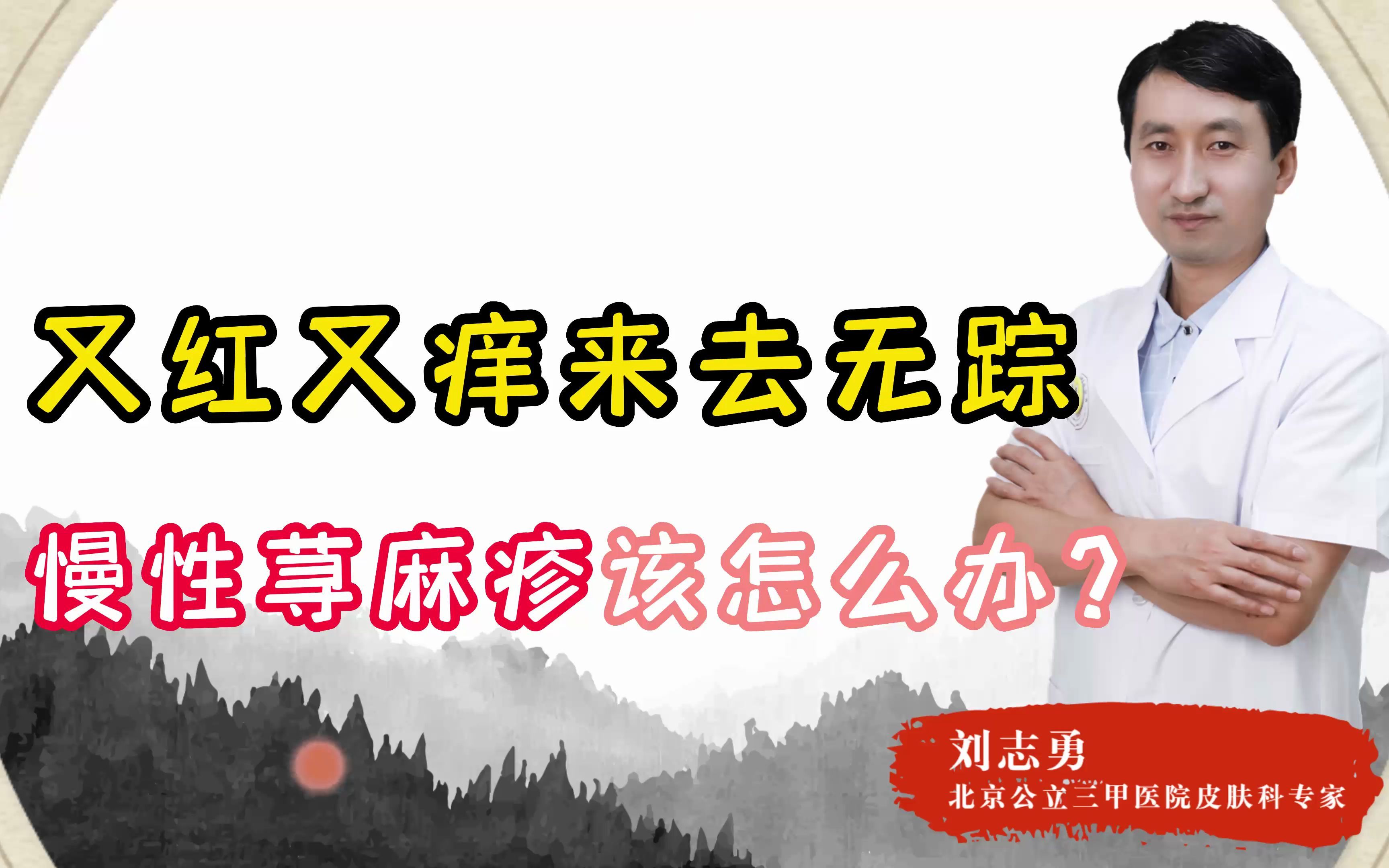 怎样治疗慢性荨麻疹最有效包括如何治疗慢性荨麻疹的详细情况