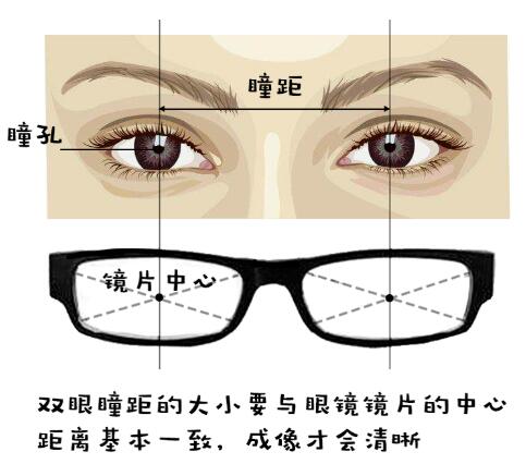 分享双眼度数差距大如何配眼镜，关于如何配眼镜的详情