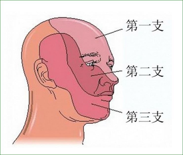 三叉神经痛有哪些症状怎样治疗到湖北地质面神经优惠包括三叉神经痛有哪些症状的详细情况