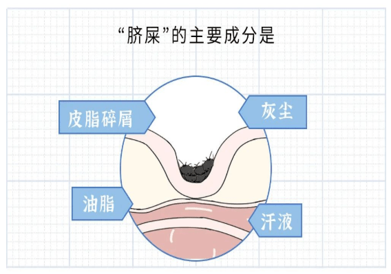 分享肚脐眼为什么会有臭味还发痒，关于肚脐眼为什么会有臭味的详情