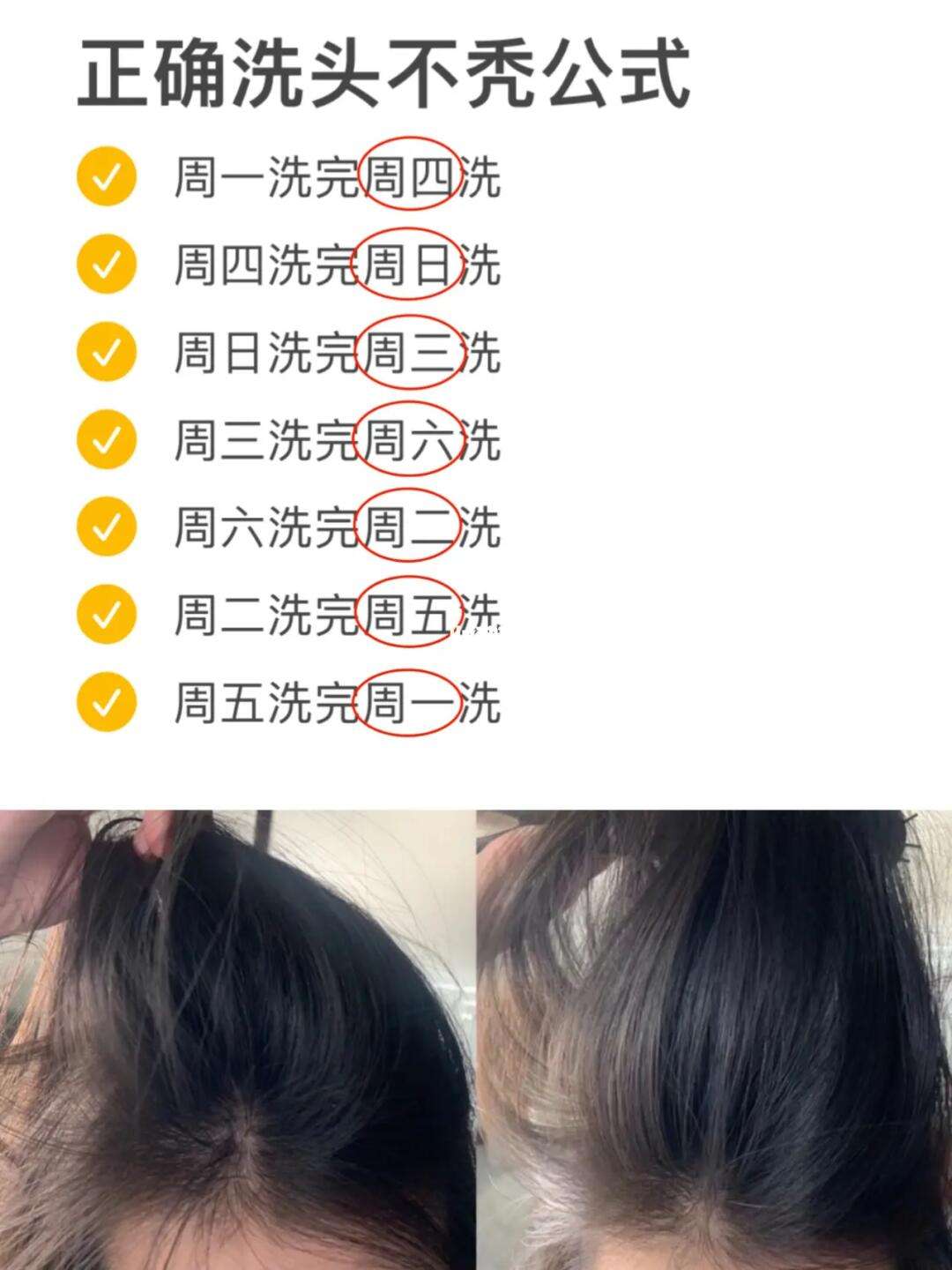 为什么洗头发时会掉很多头发平时没有和为什么洗头发时会掉很多头发的情况说明