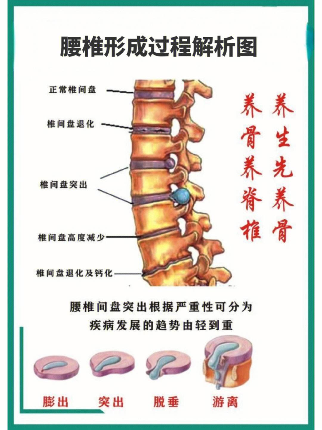 男人腰痛的原因有哪些包括腰痛的原因有哪些的具体内容