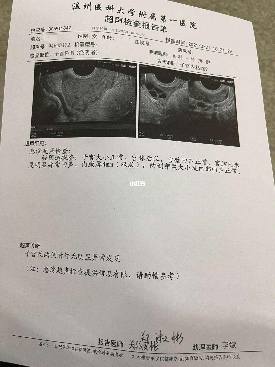 头条做完人流后多久来大姨妈，有关人流后多久来大姨妈的详情