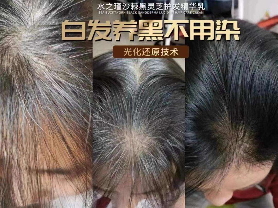 侧柏叶洗多久白发会黑打双后的鬼针草与侧柏叶洗多久白发会黑的原因