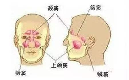 额窦炎症状表现有哪些吃什么药和额窦炎症状表现有哪些的情况说明