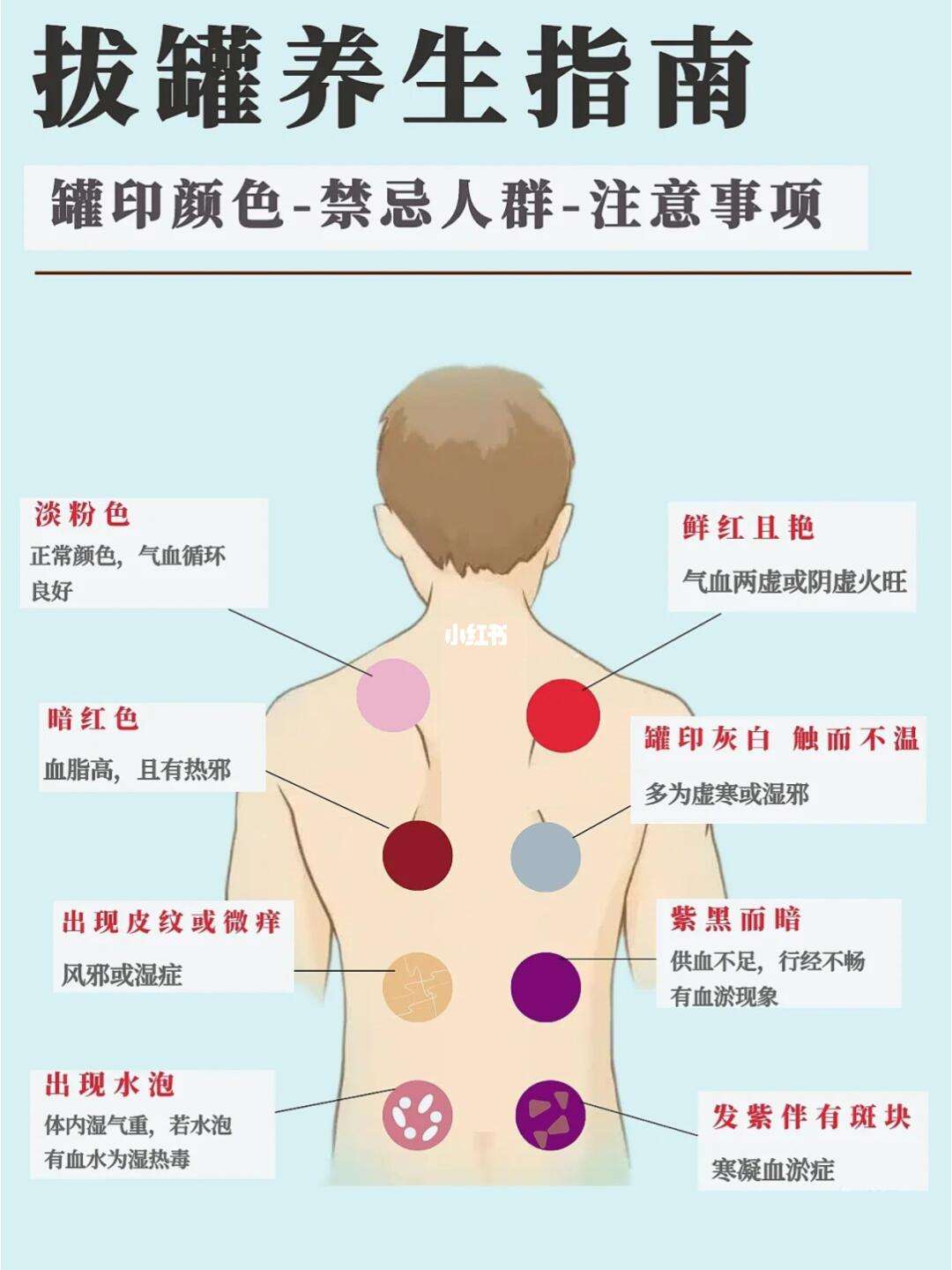 拔罐多久可以拔第二次有关拔罐多久一次合适的详细内容