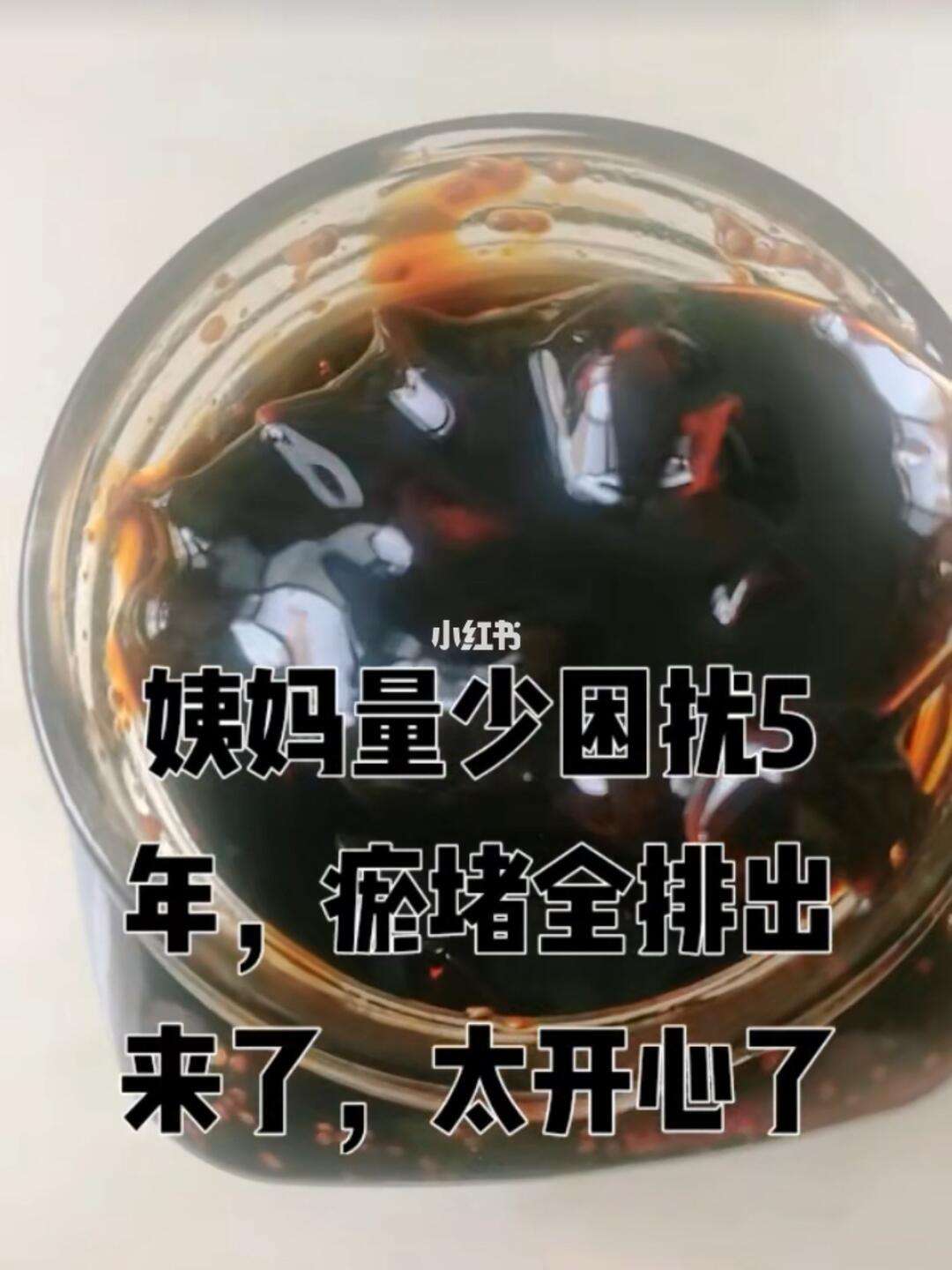 为什么月经是黑色的分泌物,不像血包括为什么月经是黑色的的具体内容