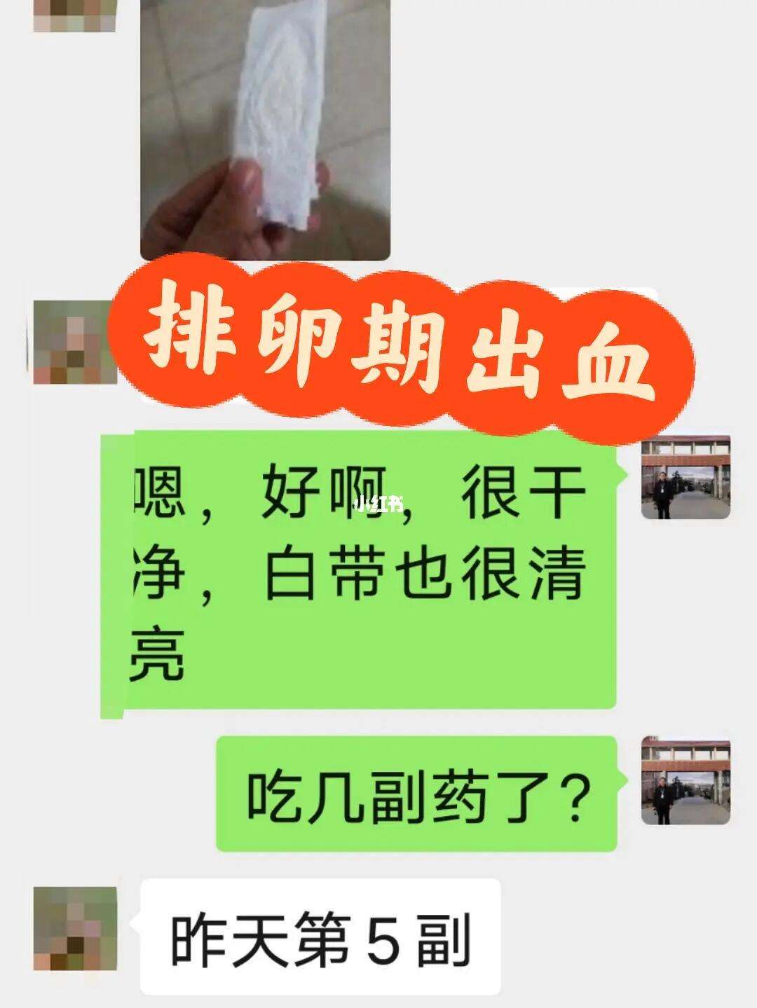 排卵期出血是为什么样子的，关于排卵期出血是为什么详细情况