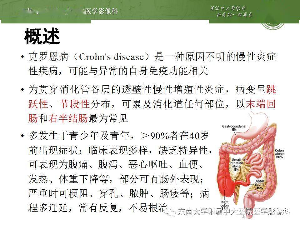 热点克罗恩病能活到80岁吗以及克罗恩病能活多久的分享