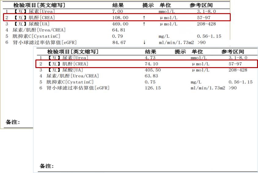 引起肌酐高的原因有哪些危害包括引起肌酐高的原因有哪些的具体内容