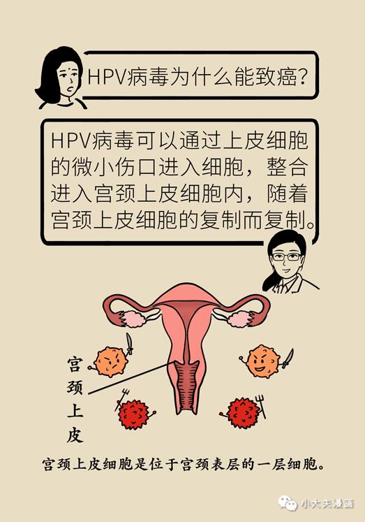 热点为什么会感染hpv51以及为什么会感染hpv的分享