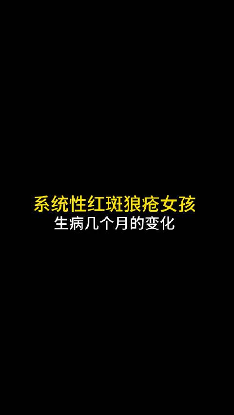 系统性红斑狼疮能活多久能治愈吗包括系统性红斑狼疮能活多久的具体内容