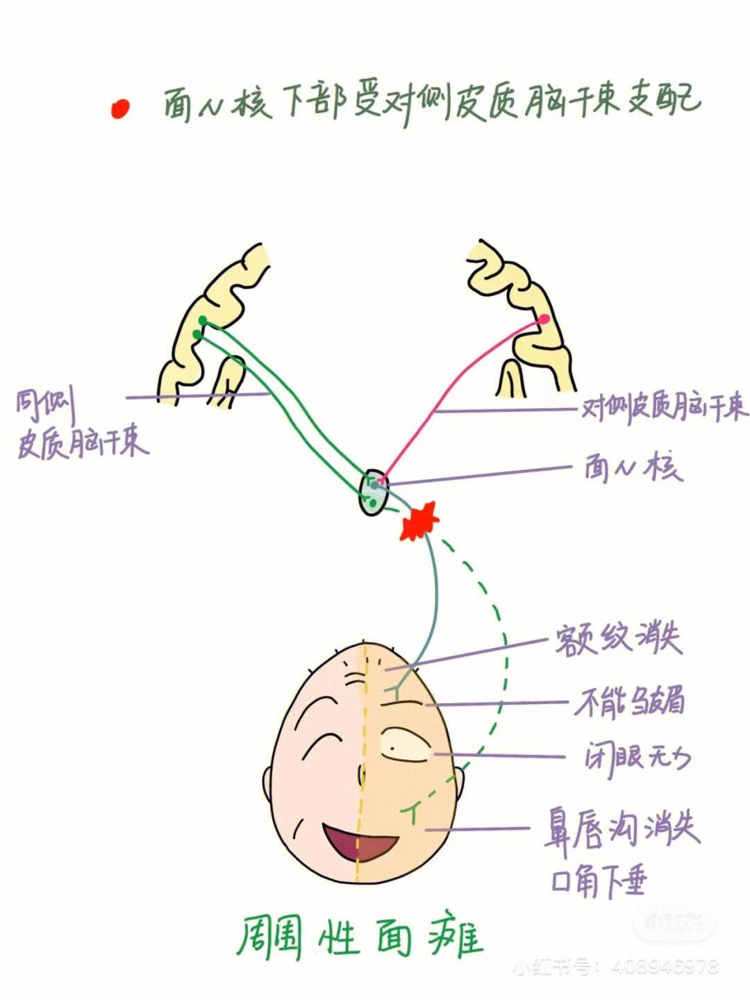 热点轻微面瘫如何治疗以及面瘫如何治疗的分享