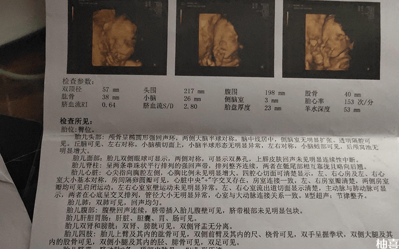 为什么肾盂分离是男孩几率大和为什么肾盂分离是男孩的详细介绍