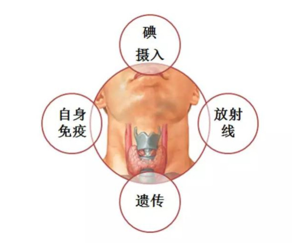 分享甲状腺结节是如何形成的 河南，关于甲状腺结节是如何形成的的详情