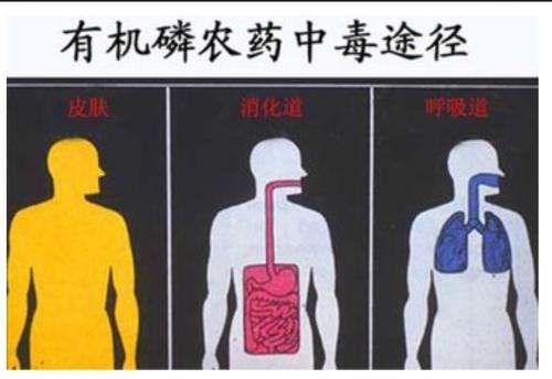 敌敌畏喝了多久会死疼苦，关于敌敌畏喝了多久会死详细情况