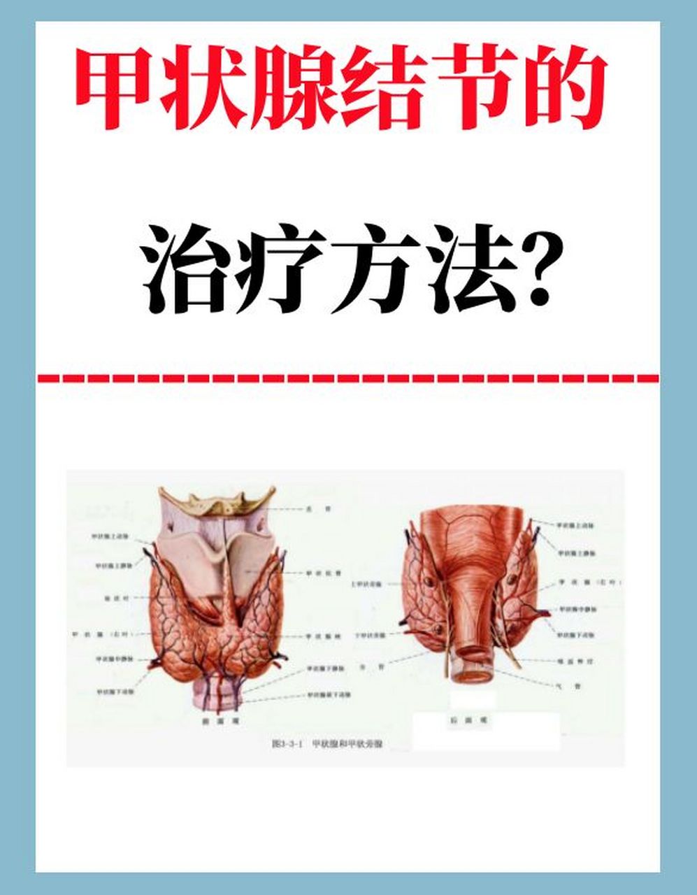 甲状腺结节如何治疗好的快 洛阳有关甲状腺结节如何治疗的详细内容