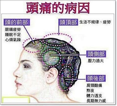 引起头疼的原因有哪些以及头疼的原因有哪些的情况分析