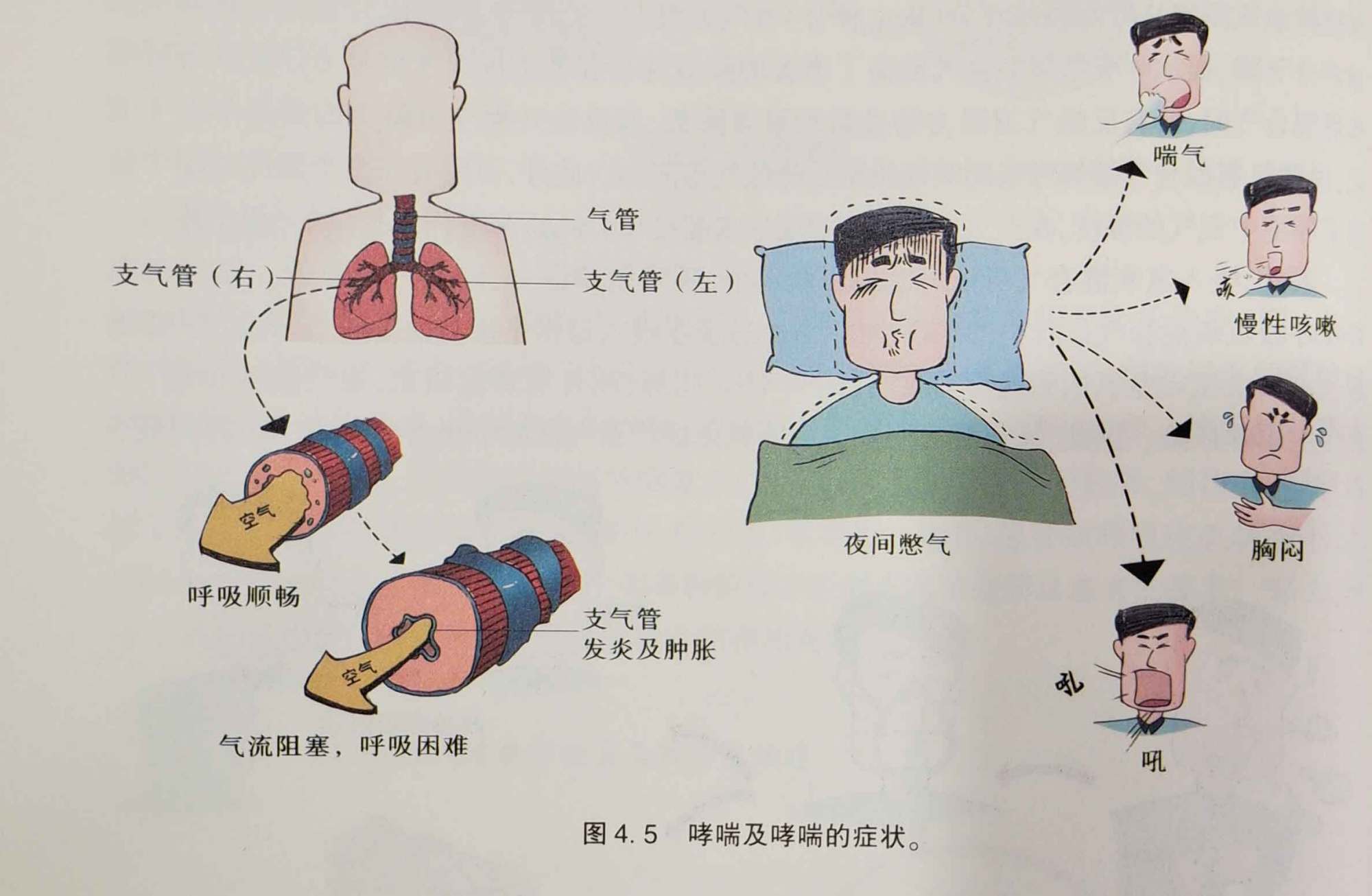 憋气多久肺功能算好的 120秒包括憋气多久肺功能算好的的具体内容