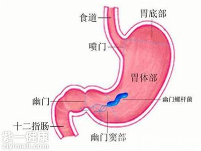 胃窦炎如何治疗好有关胃窦炎如何治疗的详细内容