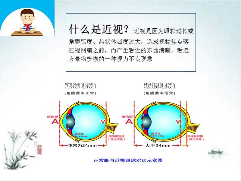 近视眼如何矫正视力包括近视眼如何矫正的具体内容