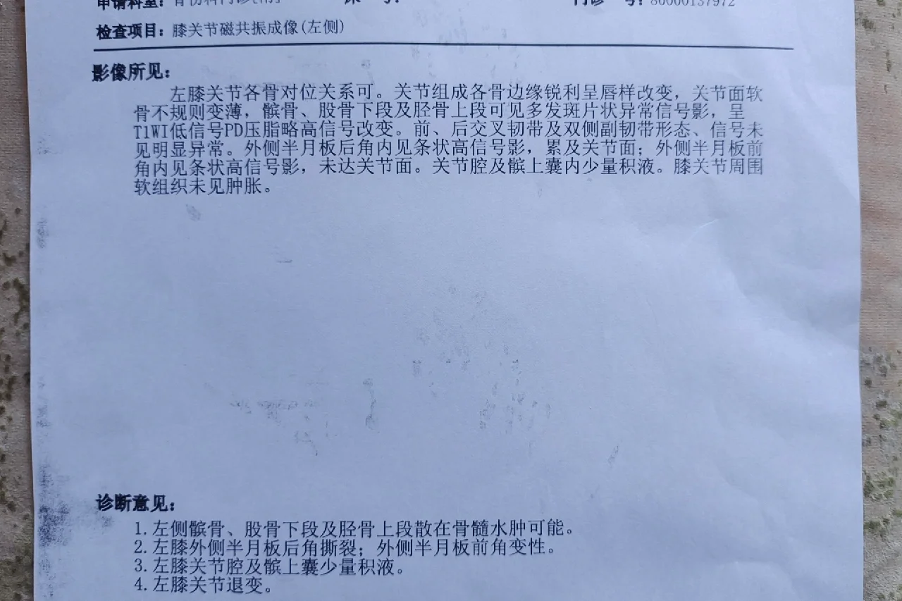 滑膜炎如何治疗按摩可以吗与滑膜炎如何治疗的原因