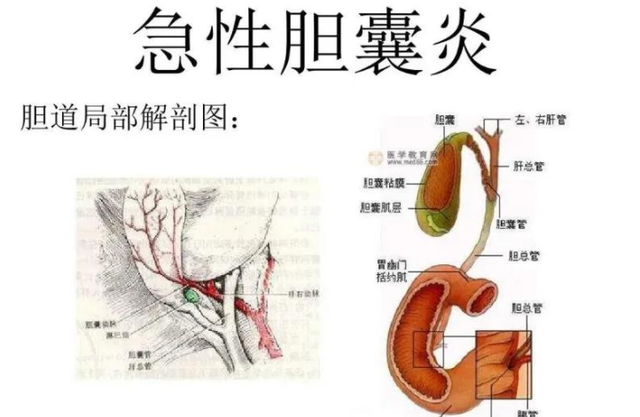 胆囊炎有哪些症状不能吃什么和胆囊炎有哪些症状的情况说明