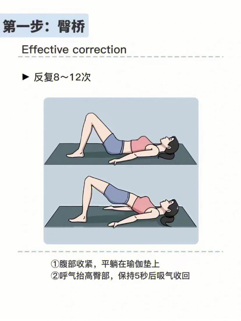 骨盆前倾的正确睡姿图，关于骨盆前倾如何矫正详细情况