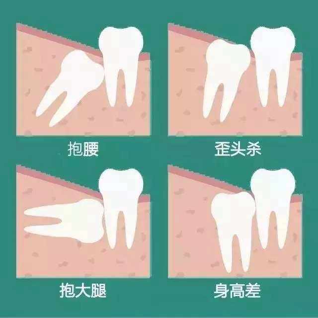 如何判断自己长智齿了牙疼以及如何判断自己长智齿了的情况分析