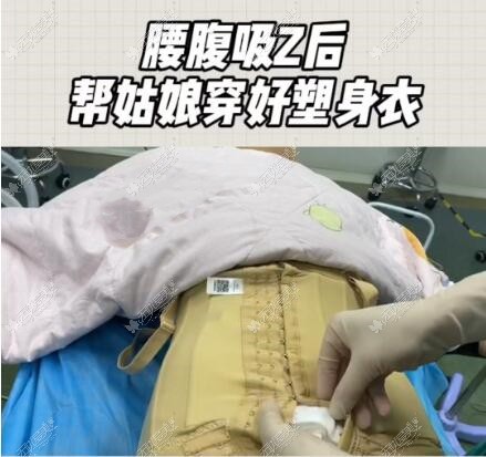 腰腹环吸抽脂需要穿多久塑身衣有关腰腹环吸抽脂需要多久恢复期的详细内容