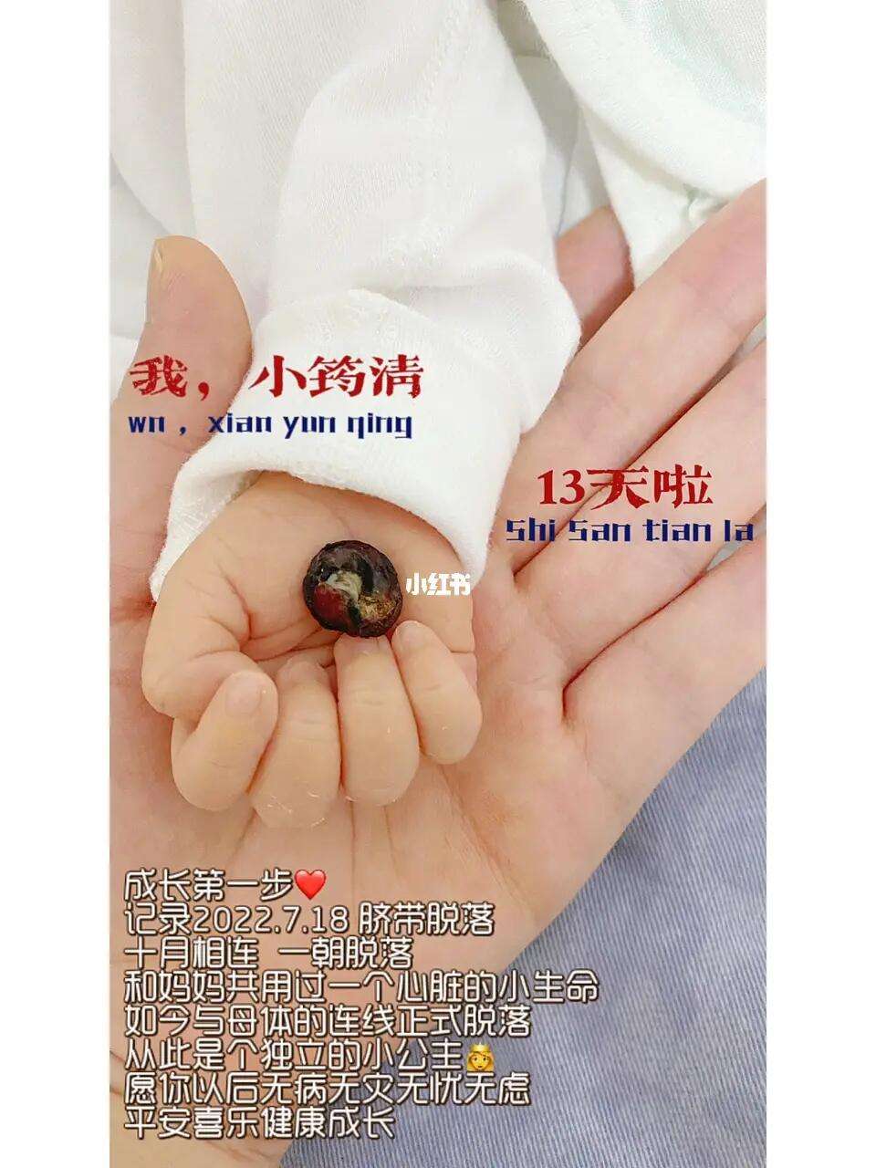 婴儿脐带多久脱落正常包括脐带多久脱落正常的详细情况