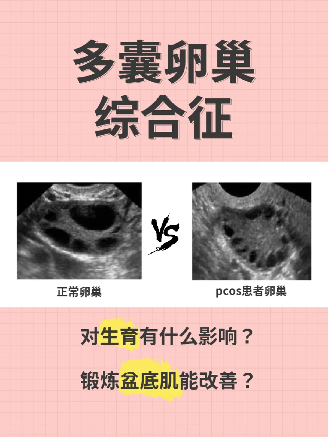 不孕为什么要查胰岛素抗体与不孕为什么要查胰岛素的原因