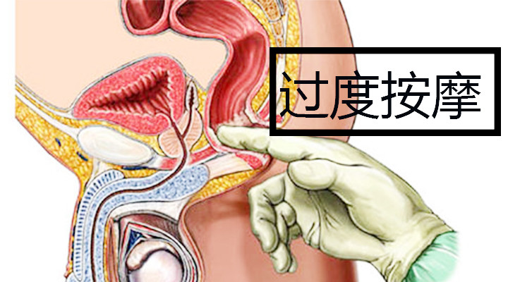 分享男性如何按摩前列腺，关于如何按摩前列腺的详情