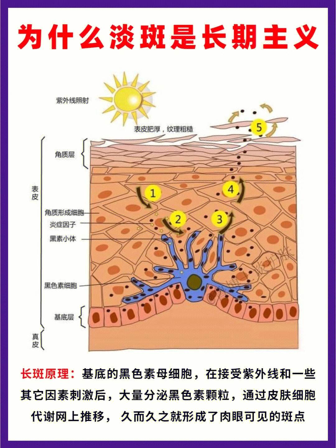 身上为什么长斑包括为什么长斑的具体内容