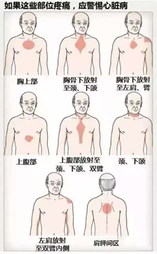 心脏病有哪些症状表现出来包括心脏病有哪些症状的具体内容