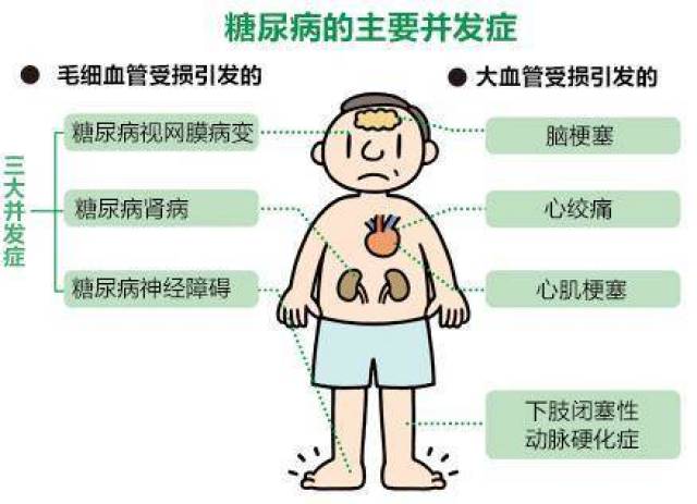 分享男性糖尿病有哪些症状，关于糖尿病有哪些症状的详情