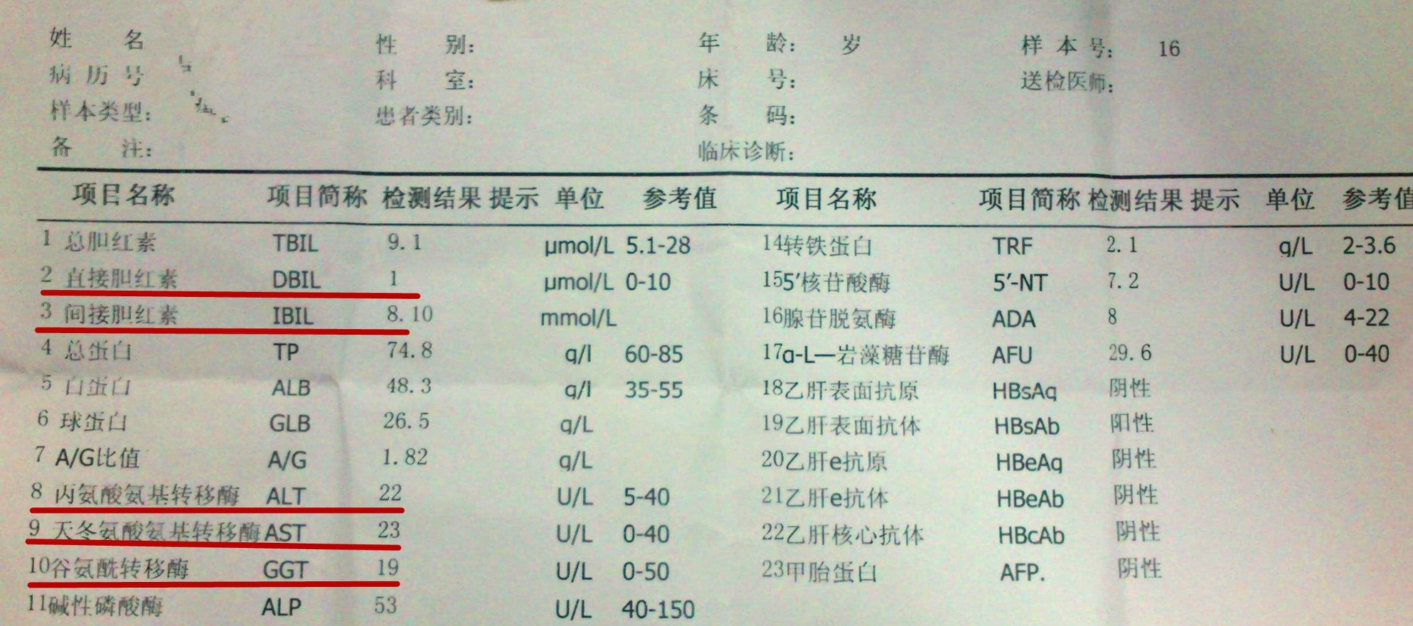 肝功能检查哪些项目是抽血吗和肝功能检查哪些项目的情况说明