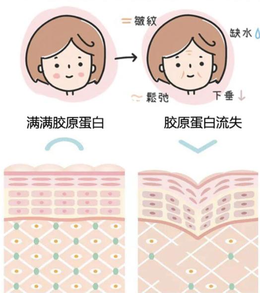 热点女人如何补充胶原蛋白以及如何补充胶原蛋白的分享